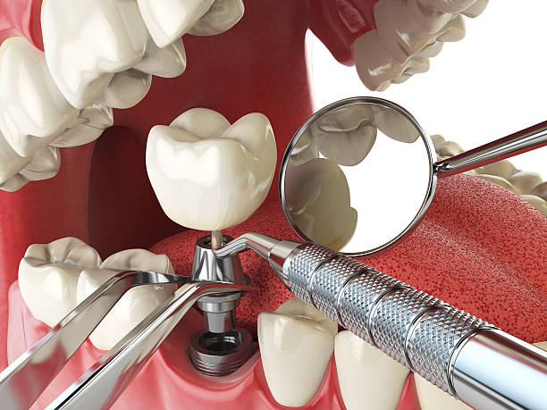 Best Same-Day Emergency Dentist in Dexter, GA