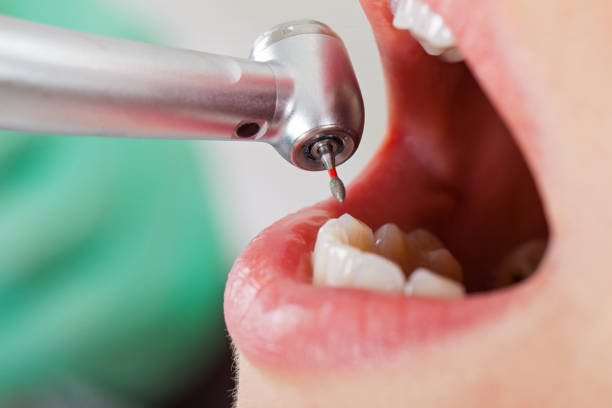 Best Emergency Treatment for Toothache in Dexter, GA